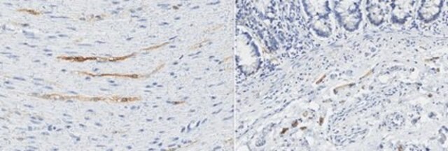 Anti-Integrin beta-8 Antibody, clone 6B9 clone 6B9, from mouse