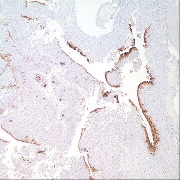 Uroplakin III (SP73) Rabbit Monoclonal Antibody