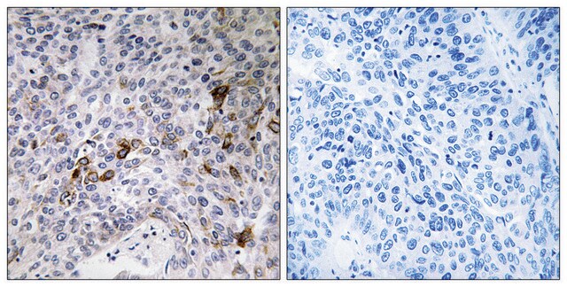 Anti-RAB11FIP3 antibody produced in rabbit affinity isolated antibody