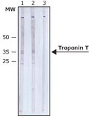 Monoclonal Anti-Troponin T antibody produced in mouse clone JLT-12, ascites fluid