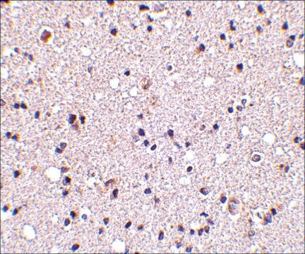 Anti-TMP21 (ab2) antibody produced in rabbit affinity isolated antibody, buffered aqueous solution