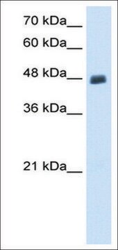 Anti-PBX2 (AB2) antibody produced in rabbit affinity isolated antibody