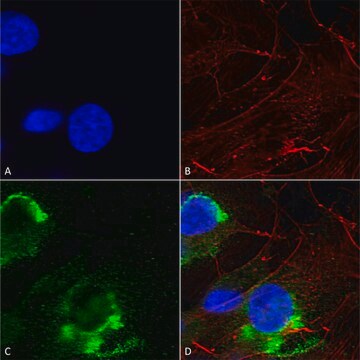 Monoclonal Anti-Lrrk2/Dardarin - Atto 488 antibody produced in mouse clone S231B-34, purified immunoglobulin