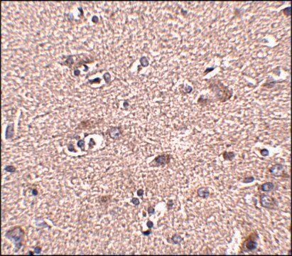 Anti-SCAMP4 antibody produced in rabbit affinity isolated antibody, buffered aqueous solution