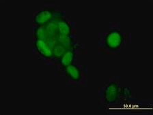 Monoclonal Anti-PGR antibody produced in mouse clone 4E9, purified immunoglobulin, buffered aqueous solution