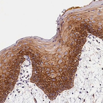 Anti-ARMC6 antibody produced in rabbit Prestige Antibodies&#174; Powered by Atlas Antibodies, affinity isolated antibody, buffered aqueous glycerol solution