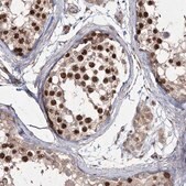 Anti-PRC1 antibody produced in rabbit Prestige Antibodies&#174; Powered by Atlas Antibodies, affinity isolated antibody, buffered aqueous glycerol solution