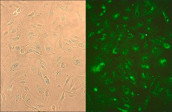 Human Lung Fibroblasts: HLF, adult