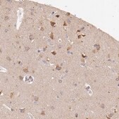 Anti-APP antibody produced in rabbit Prestige Antibodies&#174; Powered by Atlas Antibodies, affinity isolated antibody, buffered aqueous glycerol solution