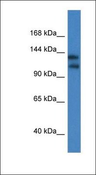 Anti-KCNT1 antibody produced in rabbit affinity isolated antibody