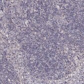 Anti-DDC antibody produced in rabbit Prestige Antibodies&#174; Powered by Atlas Antibodies, affinity isolated antibody, buffered aqueous glycerol solution