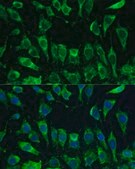 Anti-LGALS3 antibody produced in rabbit