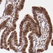 Anti-STAT6 antibody produced in rabbit affinity isolated antibody, buffered aqueous glycerol solution