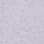 Anti-DDX20 antibody produced in rabbit Prestige Antibodies&#174; Powered by Atlas Antibodies, affinity isolated antibody, buffered aqueous glycerol solution