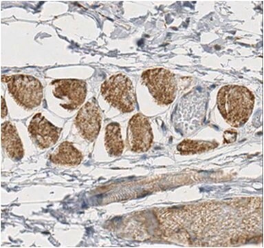 Anti-DNA polymerase subunit gamma-1 Antibody/POLG 1.0&#160;mg/mL, from rabbit