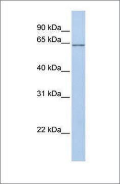 Anti-ANGPTL2 antibody produced in rabbit affinity isolated antibody