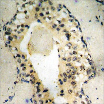 Anti-phospho-SYK (pTyr525) antibody produced in rabbit affinity isolated antibody