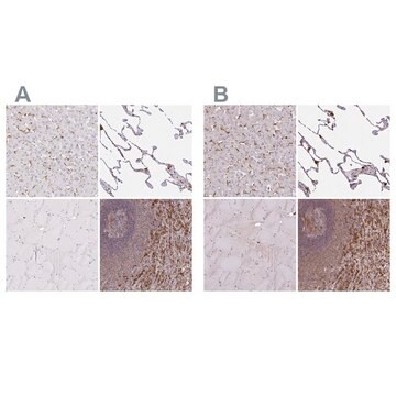 Anti-PYCARD antibody produced in rabbit Prestige Antibodies&#174; Powered by Atlas Antibodies, affinity isolated antibody, buffered aqueous glycerol solution