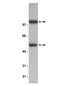 Anti-NF&#954;B p52 Antibody Upstate&#174;, from mouse