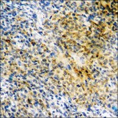 Anti-phospho-SYK (pTyr348) antibody produced in rabbit affinity isolated antibody