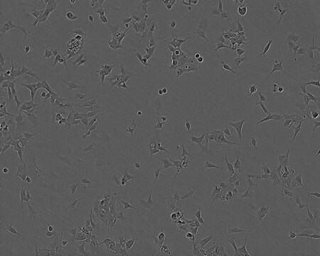 293 Cell Line human NOTE: Both the cell line and DNA from the cell line may be available for this product. Please choose -1VL or VIAL for cells, or -DNA-5UG for DNA, 85120602, human kidney (embryonic), Epithelial