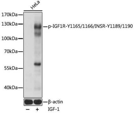 Anti-Phospho-IGF1R-Y1165/1166/INSR-Y1189/1190 antibody produced in rabbit