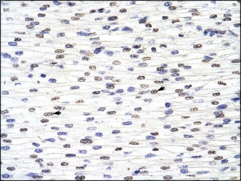 Anti-ANP32A (AB2) antibody produced in rabbit IgG fraction of antiserum