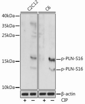 Anti-Phospho-PLN-S16 antibody produced in rabbit