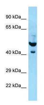 Anti-PLAUR (N-terminal) antibody produced in rabbit affinity isolated antibody