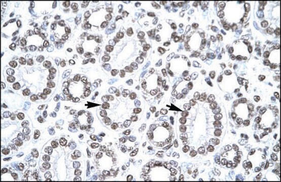 Anti-CITED1 antibody produced in rabbit affinity isolated antibody