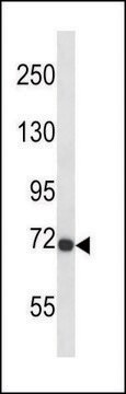 ANTI-MOUSE FGFR3 (CENTER) antibody produced in rabbit IgG fraction of antiserum, buffered aqueous solution