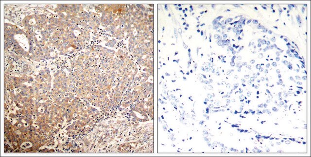 Anti-phospho-KRT18 (pSer33) antibody produced in rabbit affinity isolated antibody