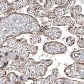Monoclonal Anti-HDAC5 antibody produced in mouse Prestige Antibodies&#174; Powered by Atlas Antibodies, clone CL8121, purified immunoglobulin, buffered aqueous glycerol solution