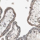 Anti-PSMB4 antibody produced in rabbit Prestige Antibodies&#174; Powered by Atlas Antibodies, affinity isolated antibody, buffered aqueous glycerol solution