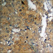 Anti-phospho-Adrenergic Receptor B2 (pSer355+Ser356) antibody produced in rabbit affinity isolated antibody