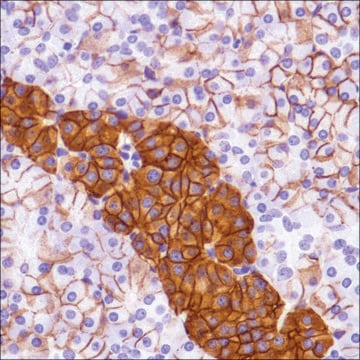 Anti-CD99 antibody, Rabbit monoclonal clone SP119, recombinant, expressed in proprietary host, affinity isolated antibody