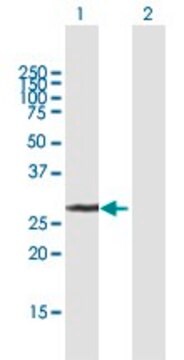 Anti-UCK2 antibody produced in mouse purified immunoglobulin, buffered aqueous solution