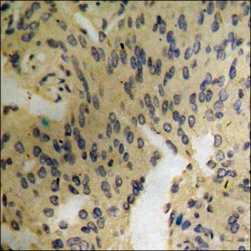 Anti-phospho-Catenin-&#946; (pTyr489) antibody produced in rabbit affinity isolated antibody