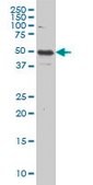 Monoclonal Anti-IL13RA2 antibody produced in mouse clone 2E10, purified immunoglobulin, buffered aqueous solution