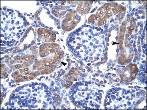 Anti-PAX7 antibody produced in rabbit affinity isolated antibody