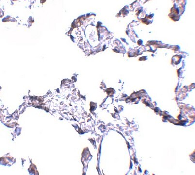 Anti-CD81 antibody produced in rabbit affinity isolated antibody