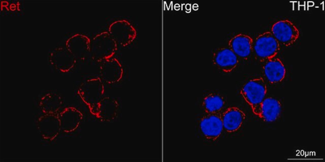 Anti-Ret Antibody, clone 3U8T6, Rabbit Monoclonal