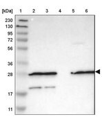 Anti-FNTA antibody produced in rabbit Prestige Antibodies&#174; Powered by Atlas Antibodies, affinity isolated antibody, buffered aqueous glycerol solution