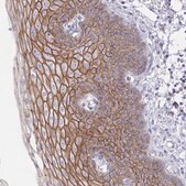 Anti-DSC3 antibody produced in rabbit Prestige Antibodies&#174; Powered by Atlas Antibodies, affinity isolated antibody, buffered aqueous glycerol solution
