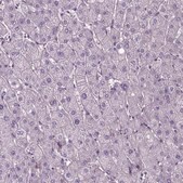Anti-JAK3 antibody produced in rabbit Prestige Antibodies&#174; Powered by Atlas Antibodies, affinity isolated antibody, buffered aqueous glycerol solution