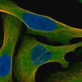 Anti-MAP3K2 antibody produced in rabbit Prestige Antibodies&#174; Powered by Atlas Antibodies, affinity isolated antibody, buffered aqueous glycerol solution