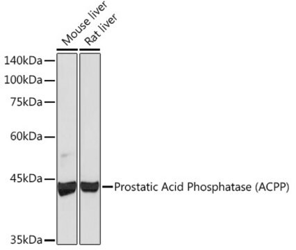 Anti-Prostatic Acid Phosphatase (ACPP) Antibody, clone 1I6S7, Rabbit Monoclonal