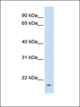 Anti-FAM107A IgG fraction of antiserum