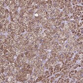 Anti-CYP11A1 antibody produced in rabbit Prestige Antibodies&#174; Powered by Atlas Antibodies, affinity isolated antibody, buffered aqueous glycerol solution
