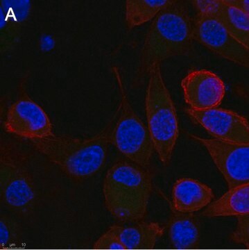 Anti-Rabies glycoprotein Antibody, clone 24-3F-10 ZooMAb&#174; Mouse Monoclonal recombinant, expressed in HEK 293 cells